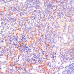 ROCK1 Polyclonal Antibody