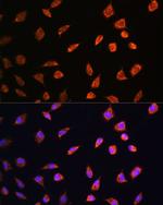 ART1 Antibody in Immunocytochemistry (ICC/IF)