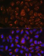 ART1 Polyclonal Antibody