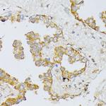 ART1 Antibody in Immunohistochemistry (Paraffin) (IHC (P))