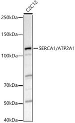SERCA1 ATPase Polyclonal Antibody