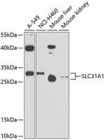 CTR1 Polyclonal Antibody