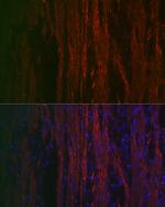 Alpha-Smooth Muscle Actin Polyclonal Antibody