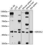 KIR3DL2 Polyclonal Antibody