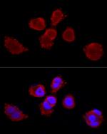 Cytokeratin 3 Polyclonal Antibody