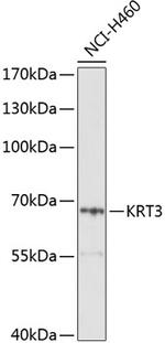 Cytokeratin 3 Antibody in Western Blot (WB)
