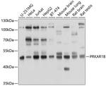 PRKAR1B Polyclonal Antibody