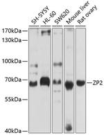 ZP2 Polyclonal Antibody