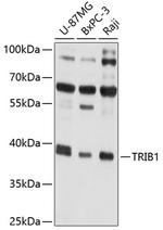 TRIB1 Polyclonal Antibody