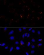 ETHE1 Polyclonal Antibody