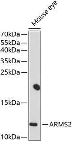 ARMS2 Polyclonal Antibody