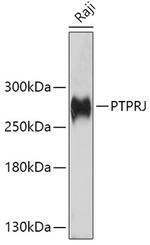 His6-DEP-1 Polyclonal Antibody