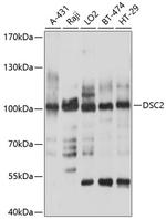 Desmocollin 2 Polyclonal Antibody