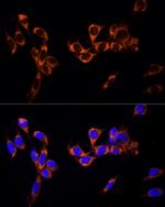 GPR30 Polyclonal Antibody