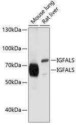 ALS Antibody in Western Blot (WB)