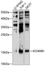 KCNMB1 Antibody in Western Blot (WB)