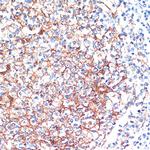 14-3-3 beta Antibody in Immunohistochemistry (Paraffin) (IHC (P))