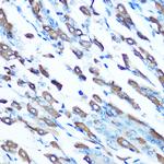 SLC11A2 Polyclonal Antibody