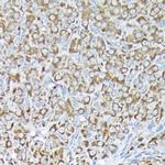 RPS15A Antibody in Immunohistochemistry (Paraffin) (IHC (P))