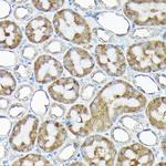 RPS15A Antibody in Immunohistochemistry (Paraffin) (IHC (P))