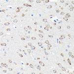 RPS15A Antibody in Immunohistochemistry (Paraffin) (IHC (P))