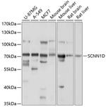 SCNN1D Polyclonal Antibody