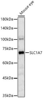SLC1A7 Polyclonal Antibody