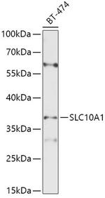 NTCP Antibody in Western Blot (WB)