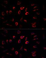 SGK1 Polyclonal Antibody