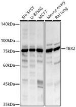 TBX2 Polyclonal Antibody