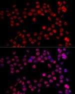 NR2F2 Polyclonal Antibody