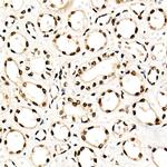 NR2F2 Antibody in Immunohistochemistry (Paraffin) (IHC (P))