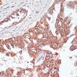 TIAM1 Antibody in Immunohistochemistry (Paraffin) (IHC (P))