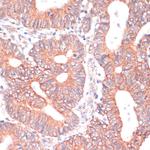 TIAM1 Polyclonal Antibody