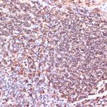 TPD52 Antibody in Immunohistochemistry (Paraffin) (IHC (P))