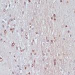 TPD52 Antibody in Immunohistochemistry (Paraffin) (IHC (P))