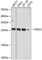 TPD52 Antibody in Western Blot (WB)