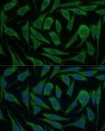 KIF14 Antibody in Immunocytochemistry (ICC/IF)