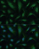 KIF14 Polyclonal Antibody