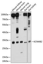 KCNMB2 Polyclonal Antibody