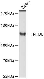 TRHDE Antibody in Western Blot (WB)