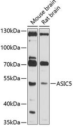 ASIC5 Polyclonal Antibody