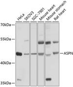 Asporin Polyclonal Antibody