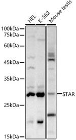 STAR Polyclonal Antibody
