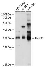 TNNT1 Polyclonal Antibody