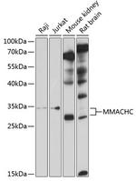 MMACHC Polyclonal Antibody