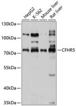 CFHR5 Polyclonal Antibody