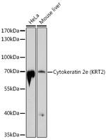 Cytokeratin 2e Polyclonal Antibody