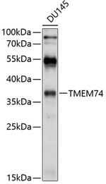 TMEM74 Polyclonal Antibody