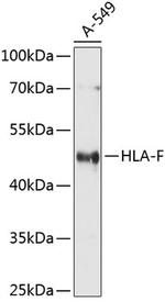 HLA-F Polyclonal Antibody